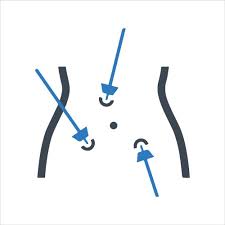 Laparoscopic Procedures
